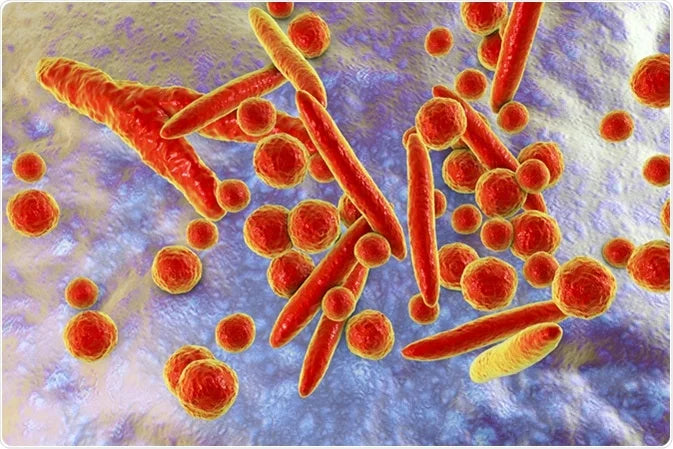 Pathogen Detection